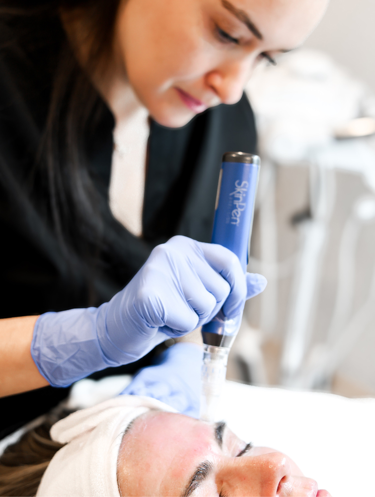 Professional microneedling skin treatment