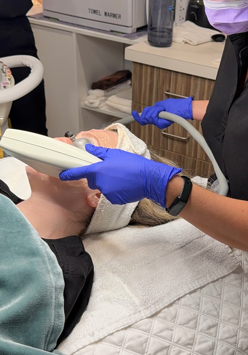 IPL Photofacial Treatments