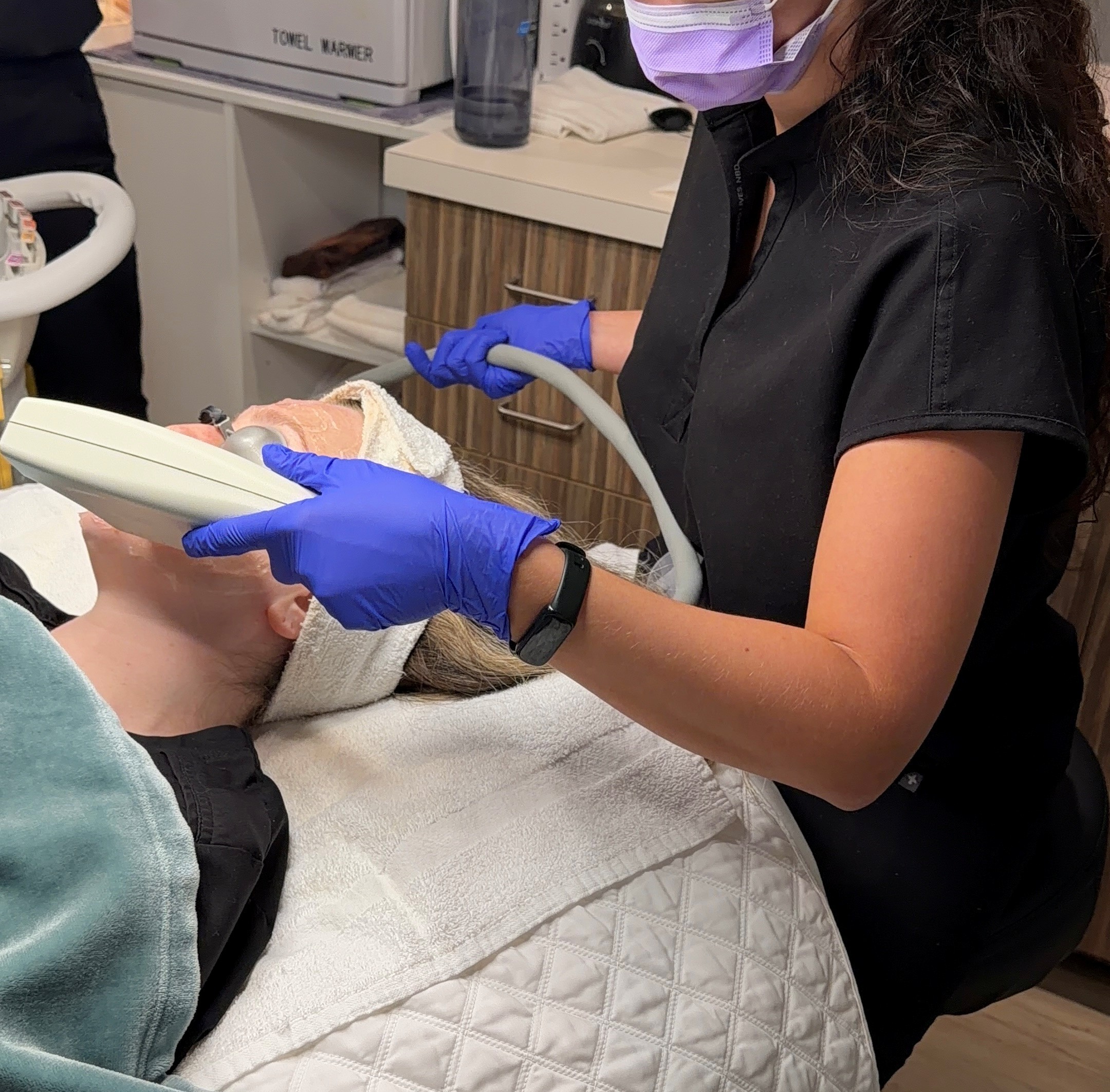IPL Photofacial Treatments